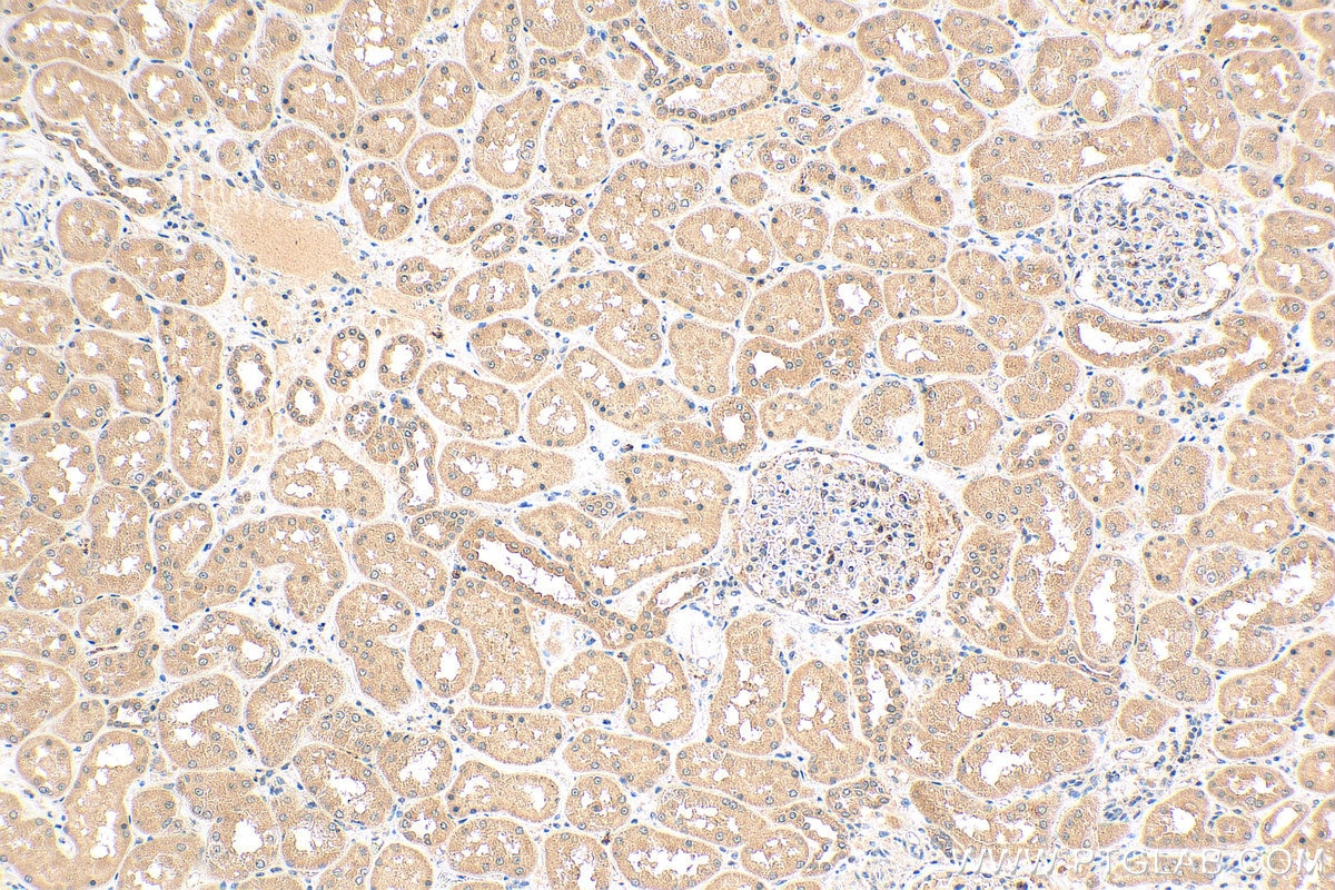 Immunohistochemistry (IHC) staining of human kidney tissue using ANKRD53 Polyclonal antibody (24283-1-AP)