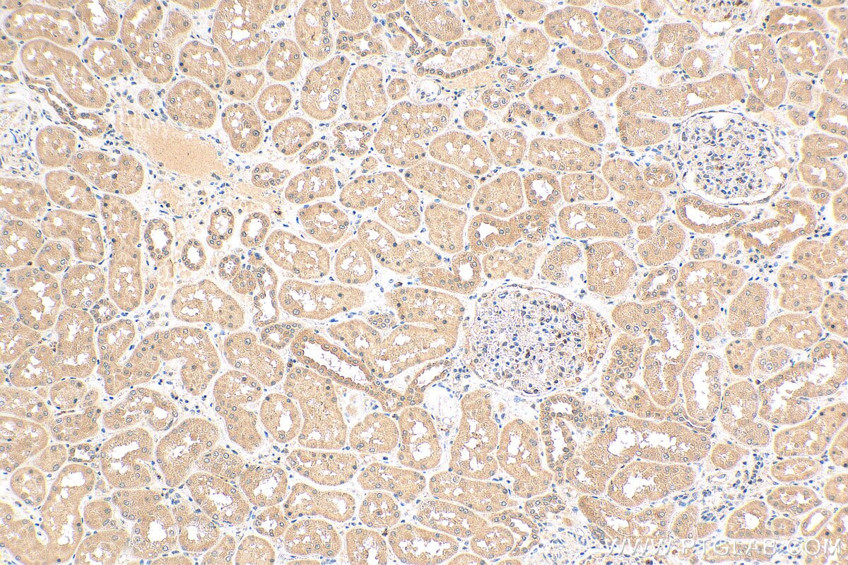 IHC staining of human kidney using 24283-1-AP