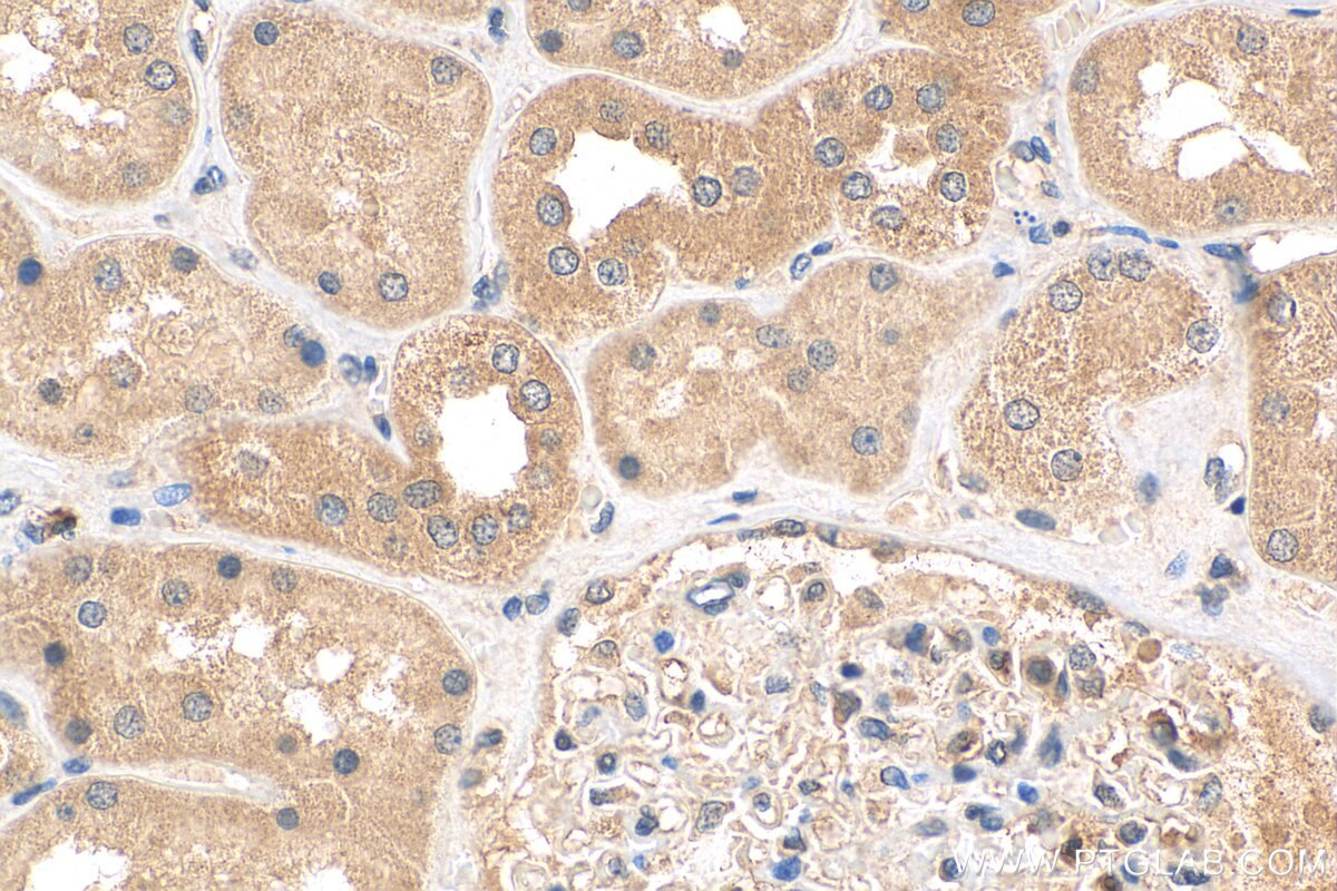 Immunohistochemistry (IHC) staining of human kidney tissue using ANKRD53 Polyclonal antibody (24283-1-AP)