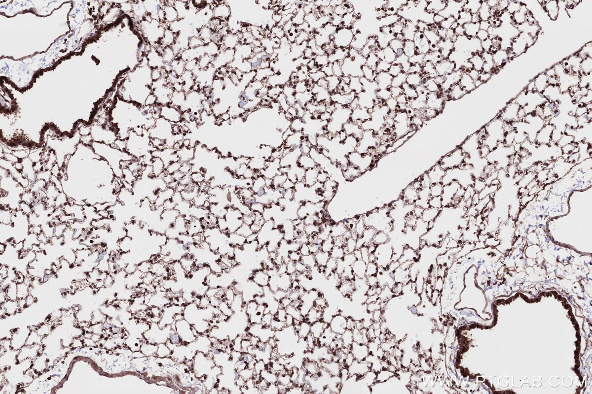 IHC staining of mouse lung using 24283-1-AP Immunohistochemistry (IHC) staining of mouse lung tissue using ANKRD53 Polyclonal antibody (24283-1-AP)
