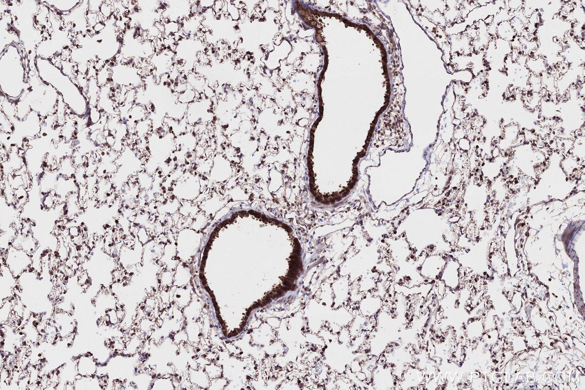 IHC staining of rat lung using 24283-1-AP Immunohistochemistry (IHC) staining of rat lung tissue using ANKRD53 Polyclonal antibody (24283-1-AP)