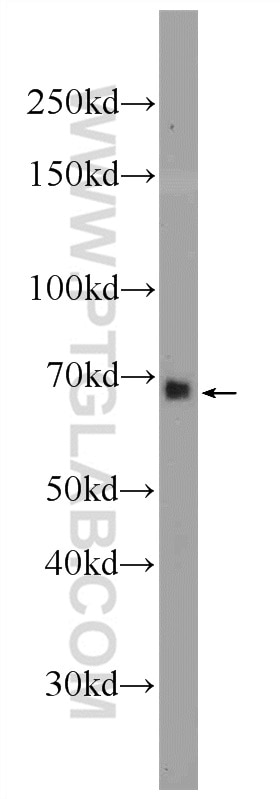 Western Blot (WB) analysis of HepG2 cells using ANKRD53 Polyclonal antibody (24283-1-AP)