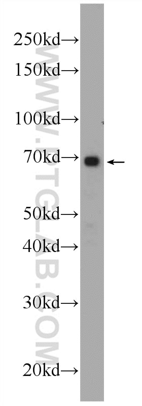 Western Blot (WB) analysis of HeLa cells using ANKRD53 Polyclonal antibody (24283-1-AP)