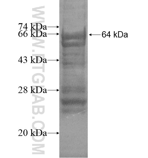 ANKRD53 fusion protein Ag15030 SDS-PAGE