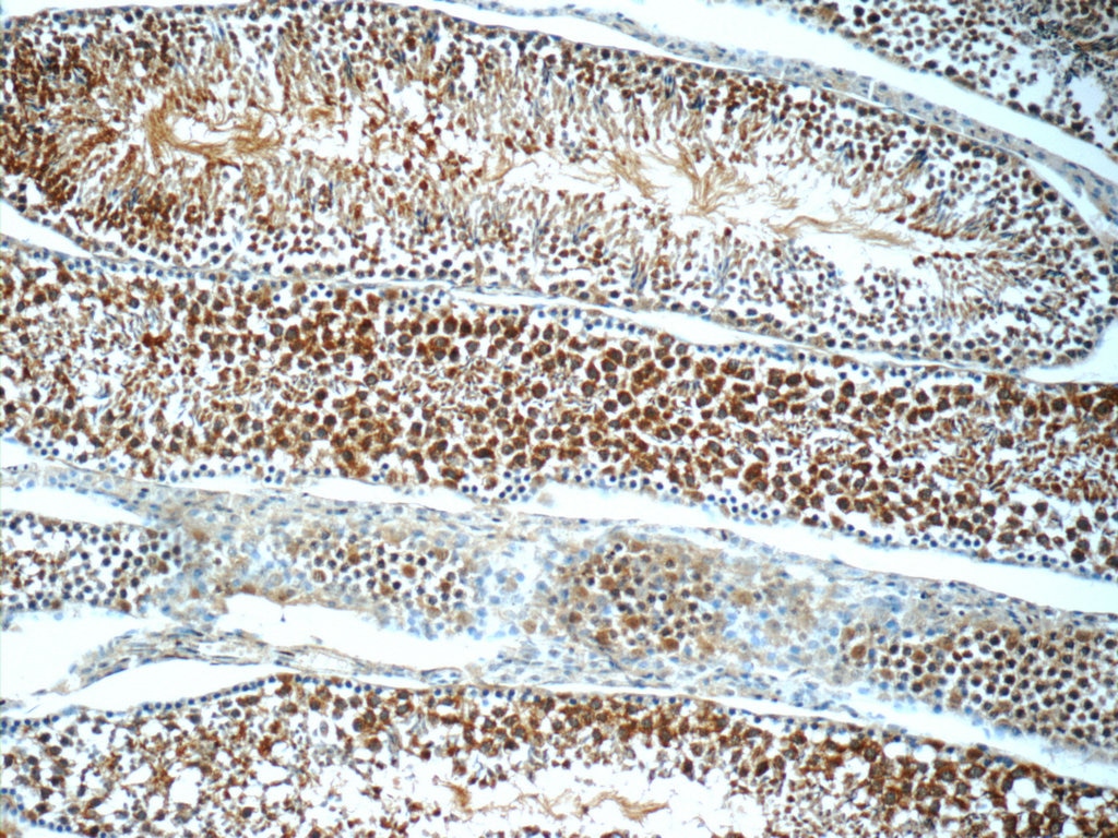 IHC staining of mouse testis using 25738-1-AP