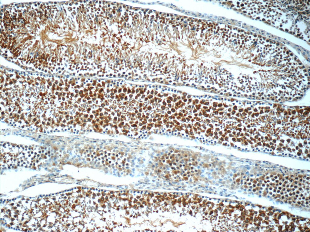 Immunohistochemistry (IHC) staining of mouse testis tissue using ANKRD54 Polyclonal antibody (25738-1-AP)