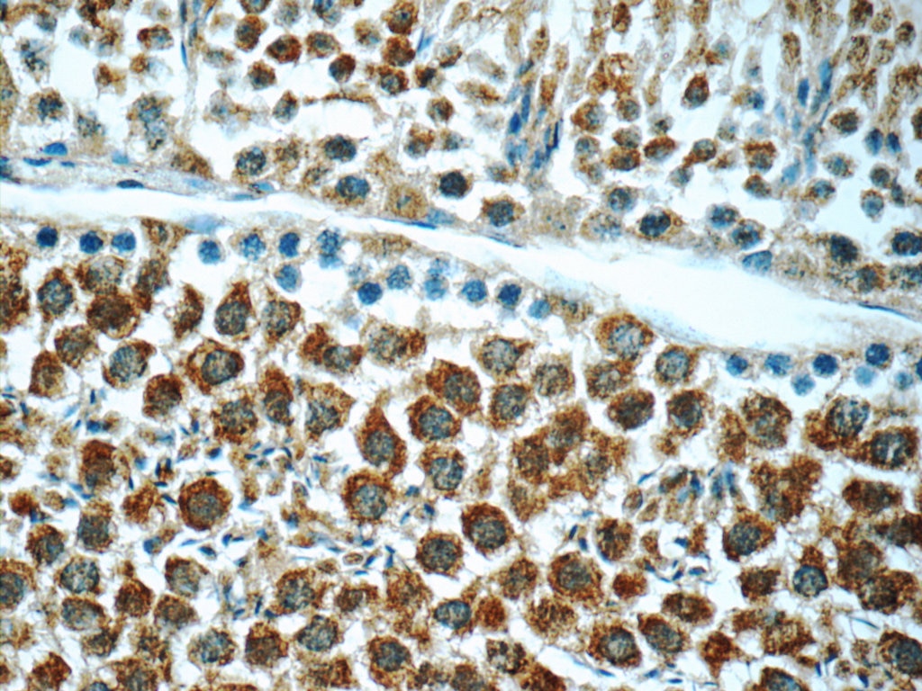 Immunohistochemistry (IHC) staining of mouse testis tissue using ANKRD54 Polyclonal antibody (25738-1-AP)