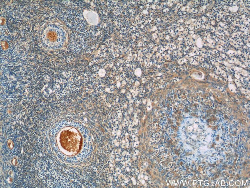 Immunohistochemistry (IHC) staining of human ovary tissue using ANKRD54 Polyclonal antibody (25738-1-AP)