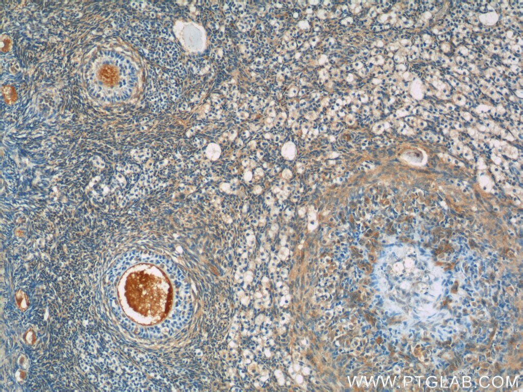 IHC staining of human ovary using 25738-1-AP