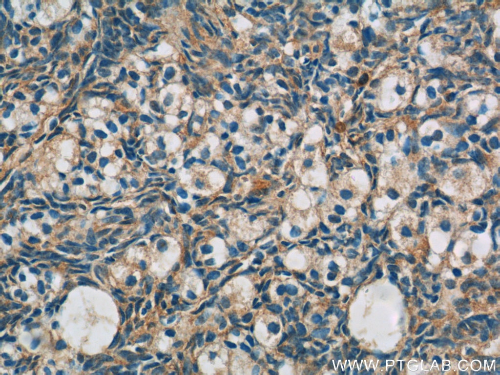 Immunohistochemistry (IHC) staining of human ovary tissue using ANKRD54 Polyclonal antibody (25738-1-AP)