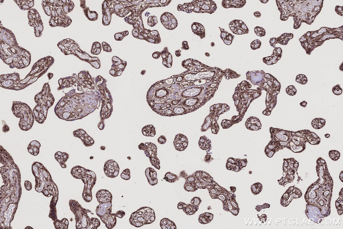 Immunohistochemistry (IHC) staining of human placenta tissue using ANKRD54 Polyclonal antibody (25738-1-AP)