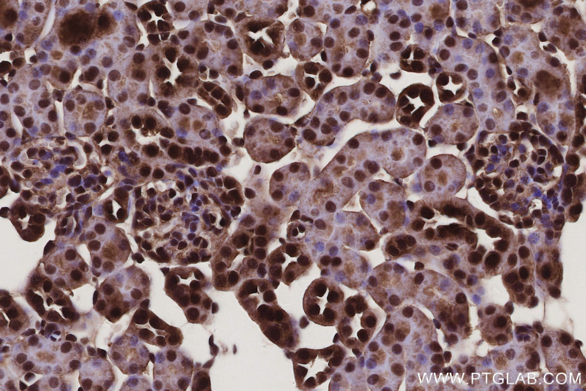 Immunohistochemistry (IHC) staining of mouse kidney tissue using ANKRD54 Polyclonal antibody (25738-1-AP)