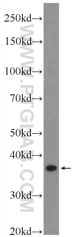 WB analysis of PC-3 using 25738-1-AP