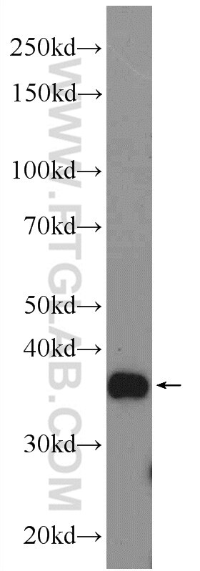 Western Blot (WB) analysis of K-562 cells using ANKRD54 Polyclonal antibody (25738-1-AP)