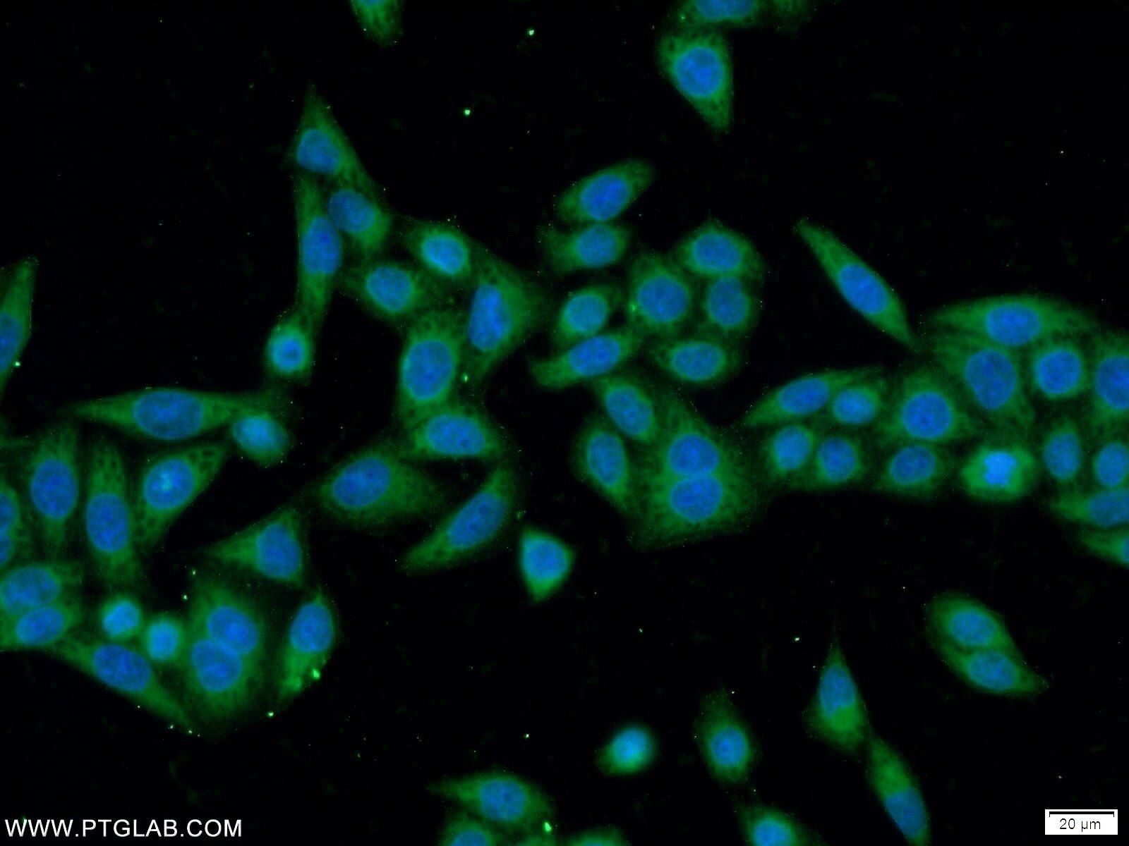 Immunofluorescence (IF) / fluorescent staining of HeLa cells using ANKRD55 Polyclonal antibody (24203-1-AP)