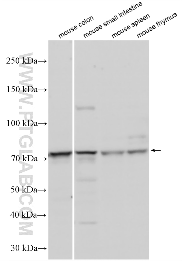 Various lysates were subjected to SDS PAGE followed by western blot with 24203-1-AP (ANKRD55 antibody) at dilution of 1:600 incubated at room temperature for 1.5 hours. Western Blot (WB) analysis of various lysates using ANKRD55 Polyclonal antibody (24203-1-AP)