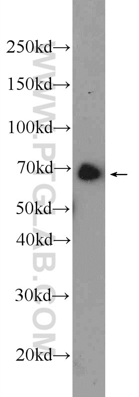 Western Blot (WB) analysis of HeLa cells using ANKRD55 Polyclonal antibody (24203-1-AP)