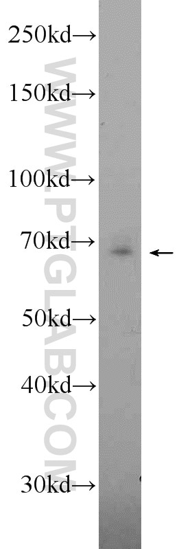 Western Blot (WB) analysis of L02 cells using ANKRD55 Polyclonal antibody (24203-1-AP)