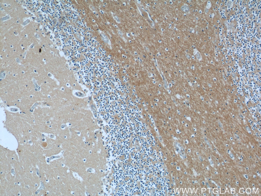 Immunohistochemistry (IHC) staining of human cerebellum tissue using ANKRD57 Polyclonal antibody (24033-1-AP)
