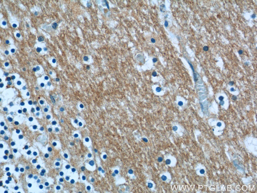 Immunohistochemistry (IHC) staining of human cerebellum tissue using ANKRD57 Polyclonal antibody (24033-1-AP)