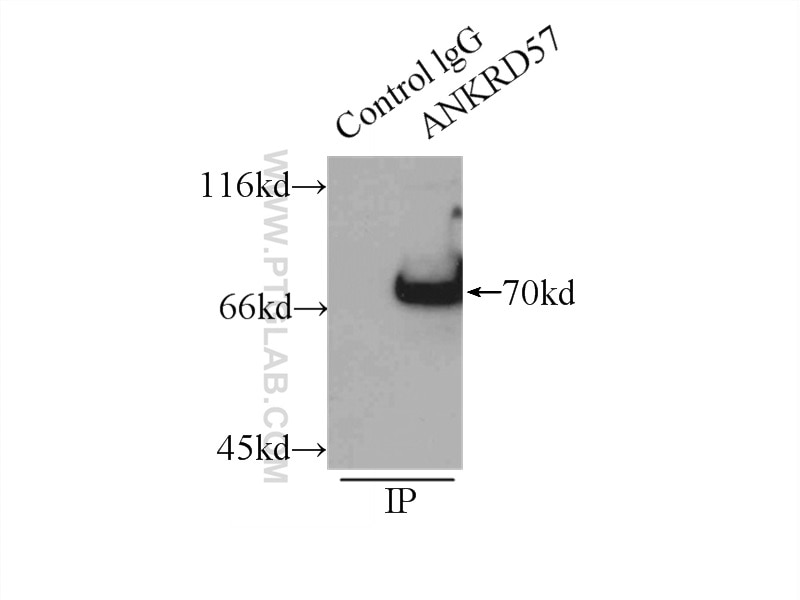 Immunoprecipitation (IP) experiment of HeLa cells using ANKRD57 Polyclonal antibody (24033-1-AP)