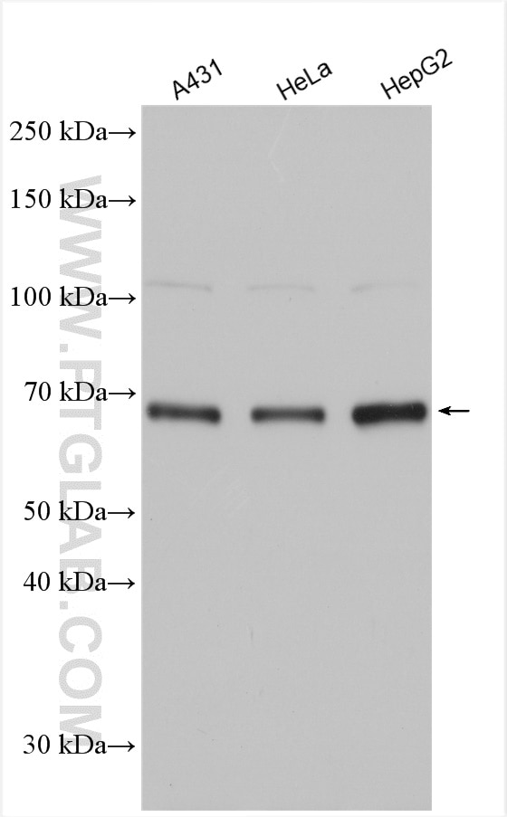 Western Blot (WB) analysis of various lysates using ANKRD57 Polyclonal antibody (24033-1-AP)