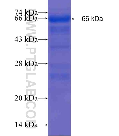 ANKRD57 fusion protein Ag21238 SDS-PAGE