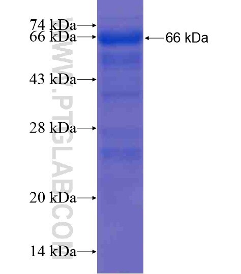 ANKRD57 fusion protein Ag21238 SDS-PAGE