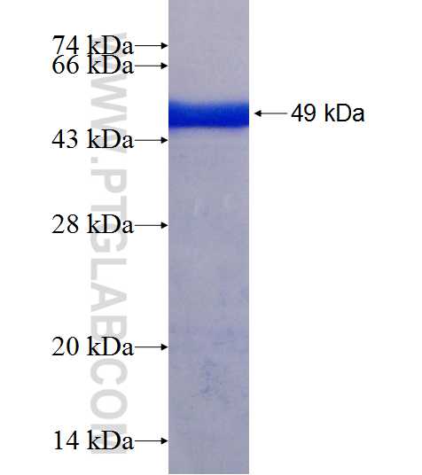 ANKRD57 fusion protein Ag21244 SDS-PAGE
