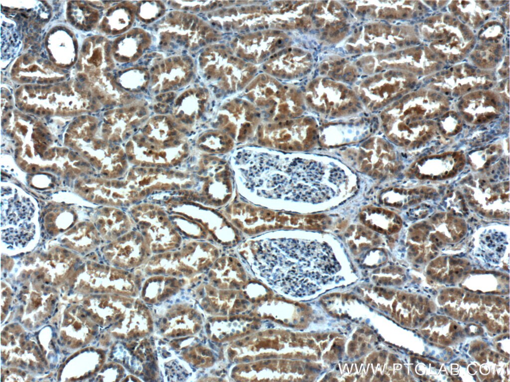 Immunohistochemistry (IHC) staining of human kidney tissue using ANKRD6 Polyclonal antibody (24333-1-AP)