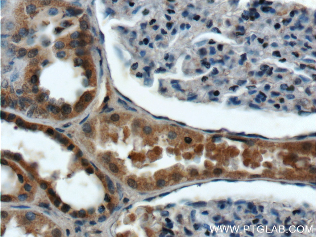 Immunohistochemistry (IHC) staining of human kidney tissue using ANKRD6 Polyclonal antibody (24333-1-AP)