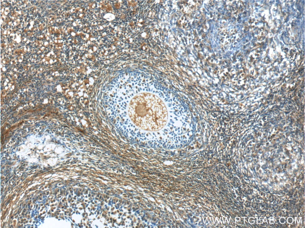 Immunohistochemistry (IHC) staining of human ovary tissue using ANKRD6 Polyclonal antibody (24333-1-AP)