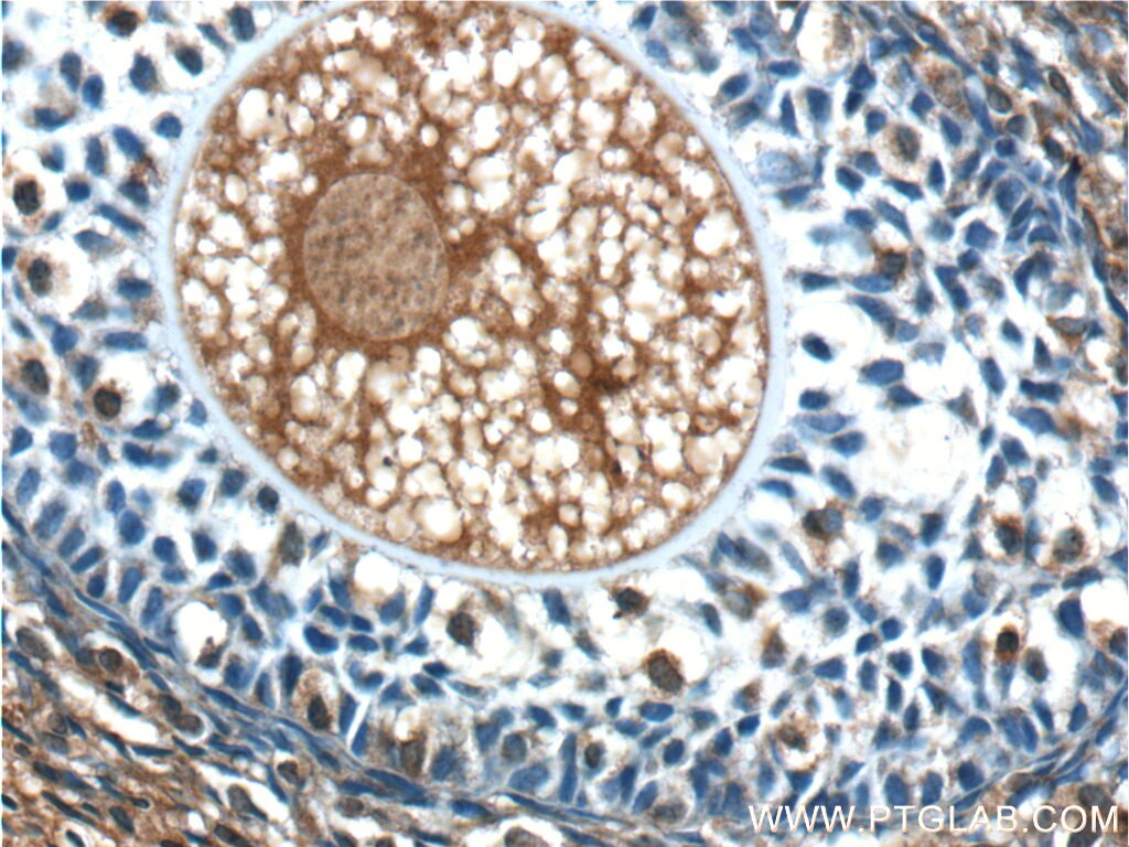 Immunohistochemistry (IHC) staining of human ovary tissue using ANKRD6 Polyclonal antibody (24333-1-AP)