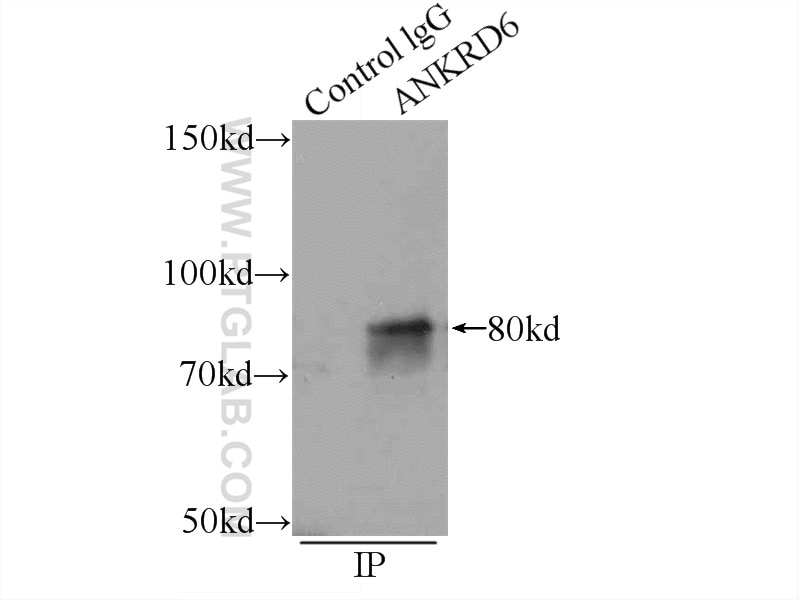 Immunoprecipitation (IP) experiment of HEK-293 cells using ANKRD6 Polyclonal antibody (24333-1-AP)