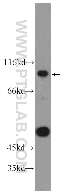 Western Blot (WB) analysis of HEK-293 cells using ANKRD6 Polyclonal antibody (24333-1-AP)
