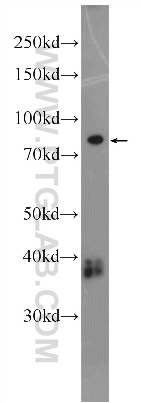 Western Blot (WB) analysis of fetal human brain tissue using ANKRD6 Polyclonal antibody (24333-1-AP)