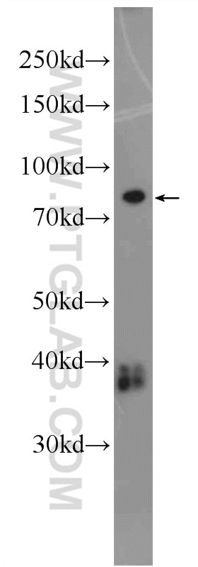 WB analysis of fetal human brain using 24333-1-AP