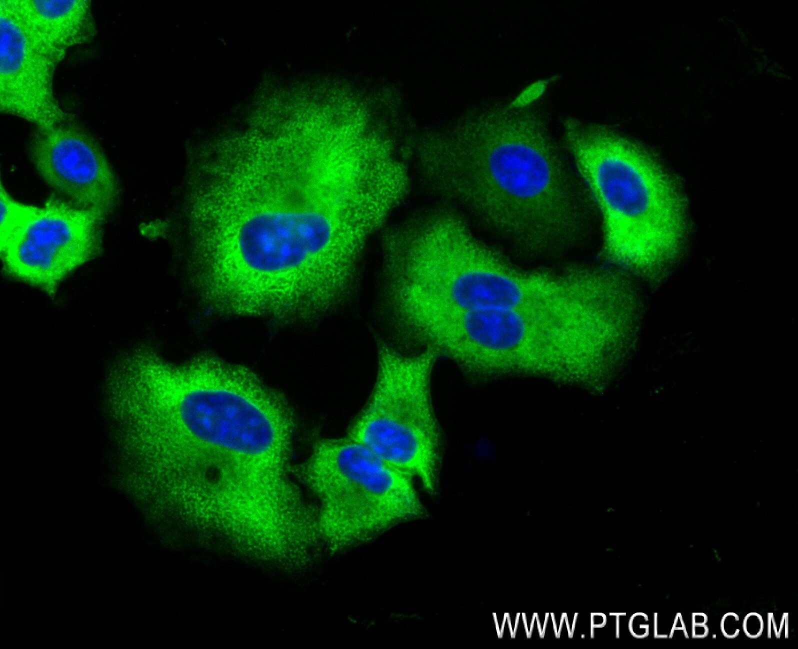 Immunofluorescence (IF) / fluorescent staining of A549 cells using ANKRD6 Recombinant antibody (84210-4-RR)