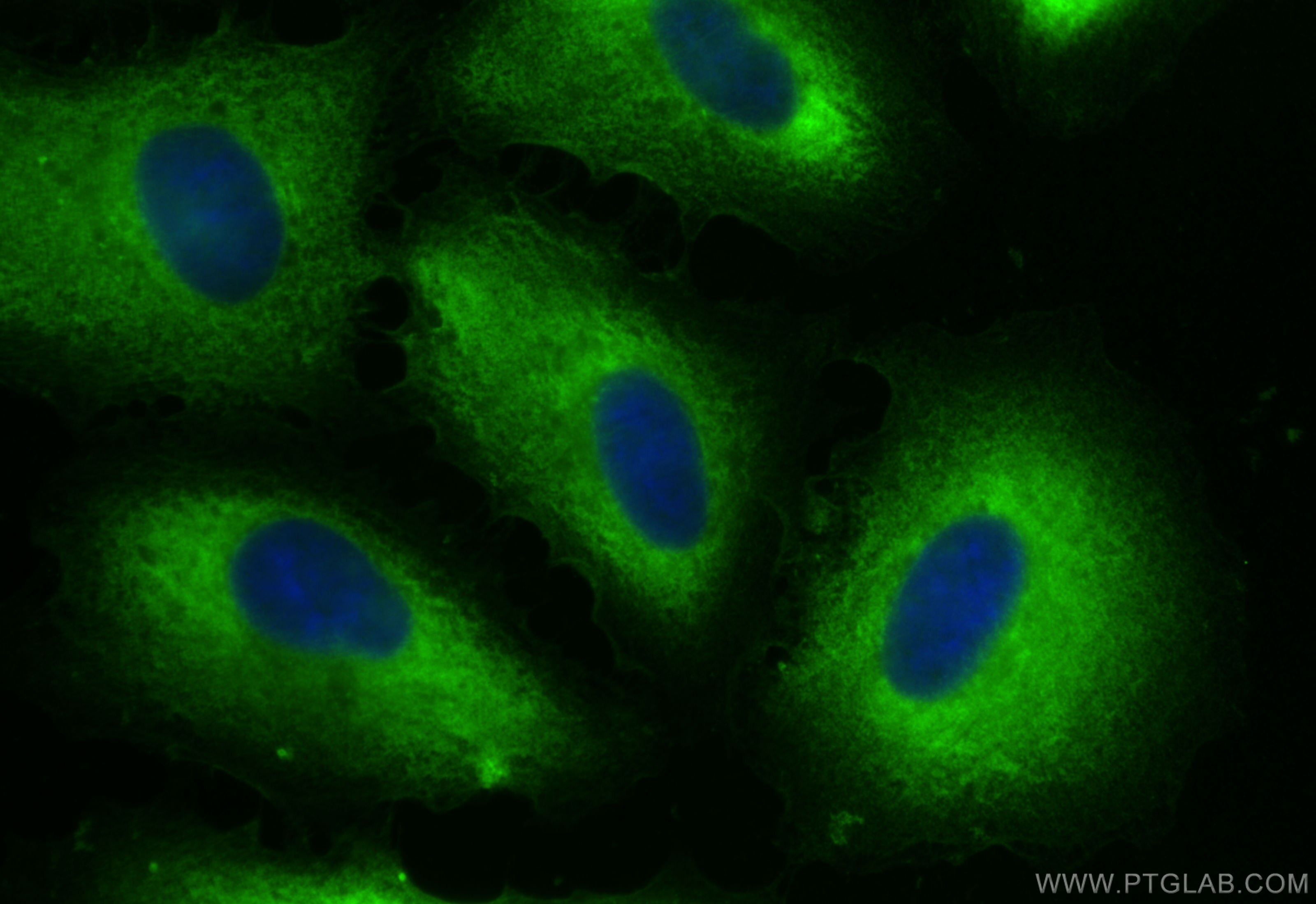 Immunofluorescence (IF) / fluorescent staining of A549 cells using CoraLite® Plus 488-conjugated ANKRD6 Recombinant a (CL488-84210-4)