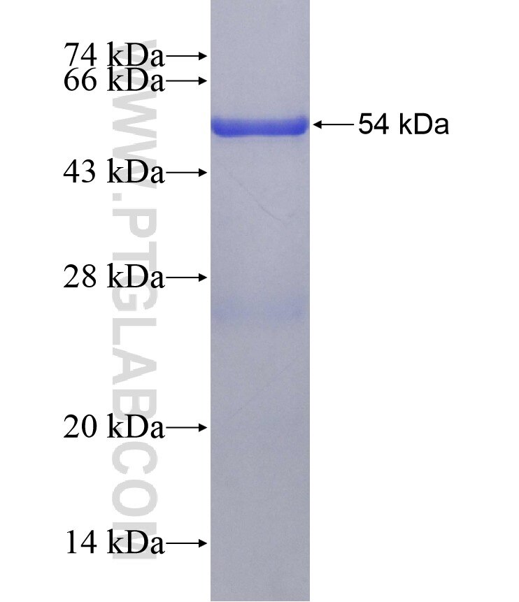 ANKRD6 fusion protein Ag19328 SDS-PAGE