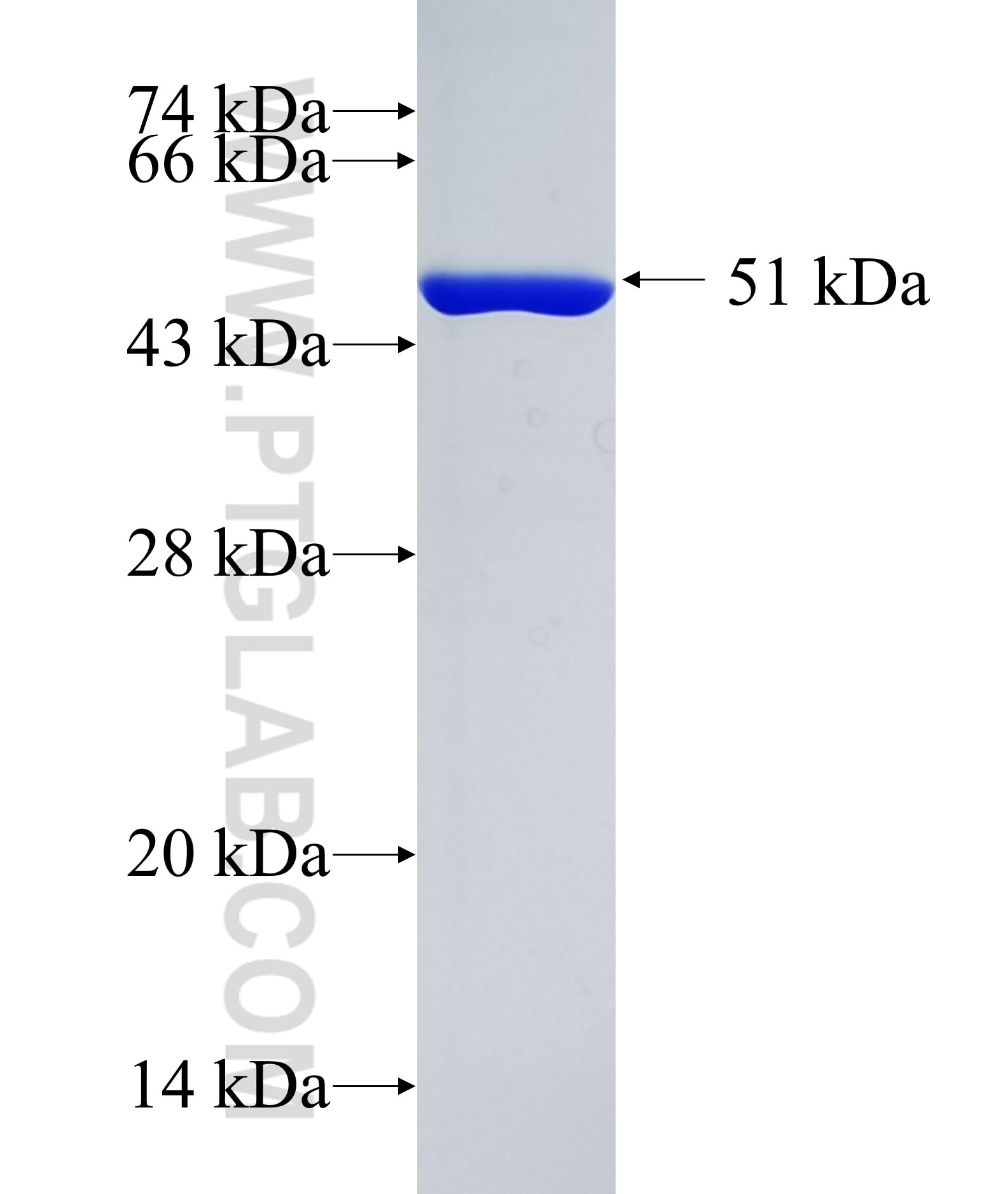 ANKRD6 fusion protein Ag19328 SDS-PAGE