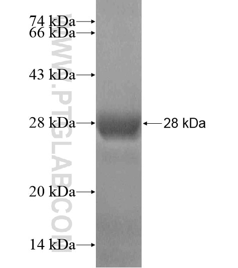ANKRD6 fusion protein Ag19368 SDS-PAGE