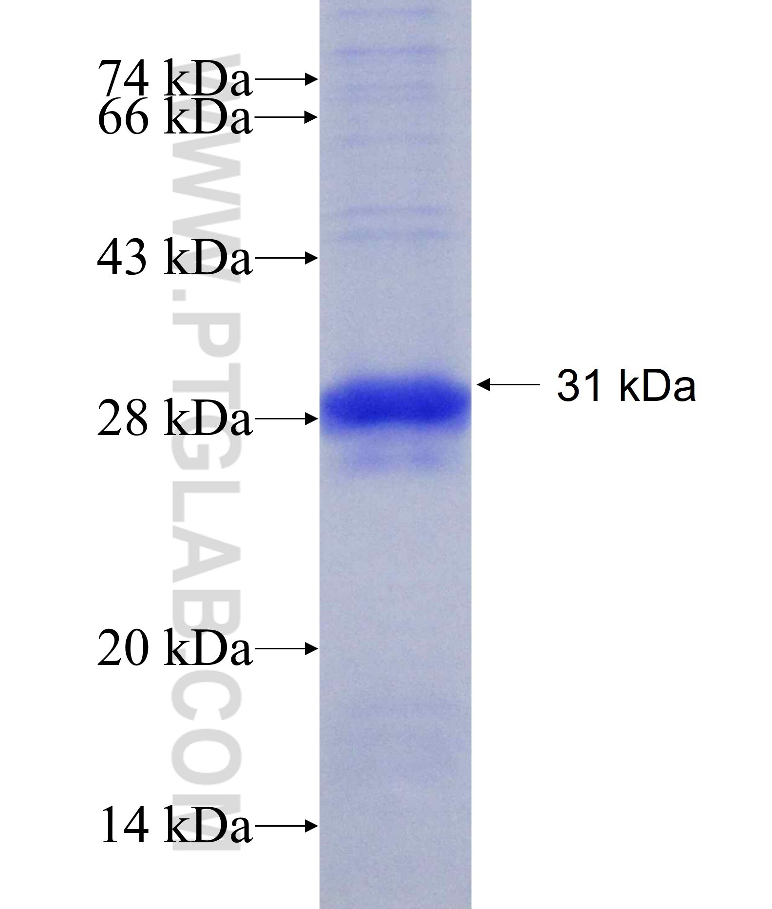 ANKRD6 fusion protein Ag19368 SDS-PAGE