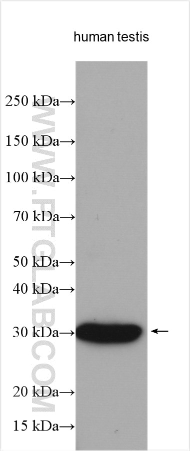 Western Blot (WB) analysis of various lysates using ANKRD7 Polyclonal antibody (21023-1-AP)