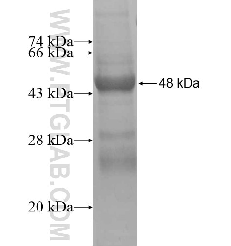 ANKRD7 fusion protein Ag15285 SDS-PAGE