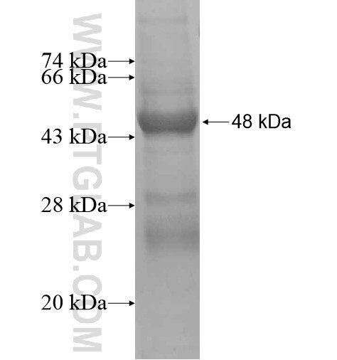 ANKRD7 fusion protein Ag15285 SDS-PAGE