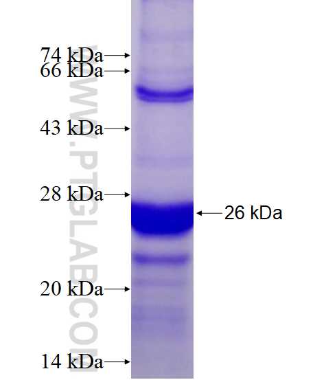 ANKRD7 fusion protein Ag15507 SDS-PAGE