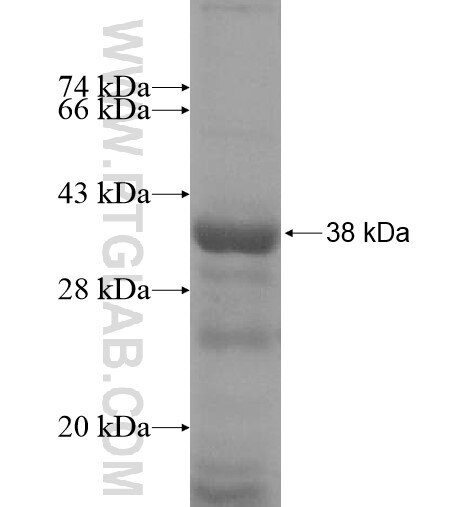 ANKRD9 fusion protein Ag15328 SDS-PAGE