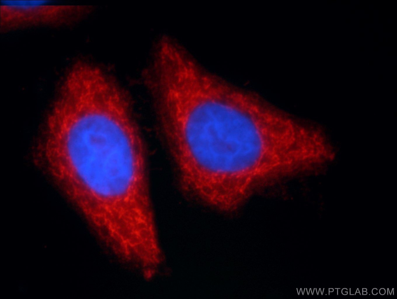 Immunofluorescence (IF) / fluorescent staining of HepG2 cells using ANKS1B Polyclonal antibody (24783-1-AP)