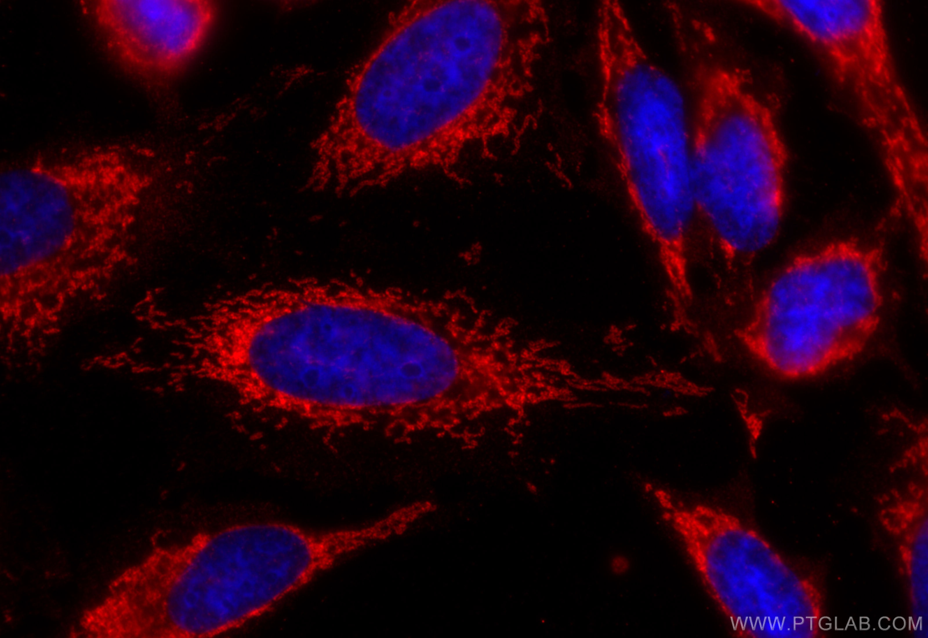 Immunofluorescence (IF) / fluorescent staining of HeLa cells using ANKS1B Polyclonal antibody (24783-1-AP)